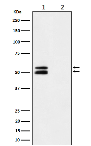 Phospho-CaMKII alpha (Thr286) Antibody in Western Blot (WB)