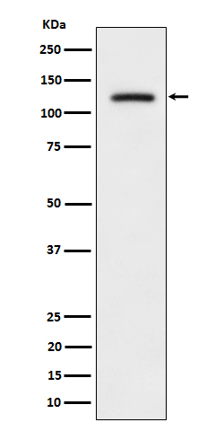 Phospho-ULK1 (Ser556) Antibody in Western Blot (WB)