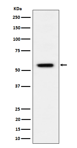 Phospho-Vimentin (Ser39) Antibody in Western Blot (WB)