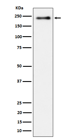 Phospho-LRP6 (Ser1490) Antibody in Western Blot (WB)
