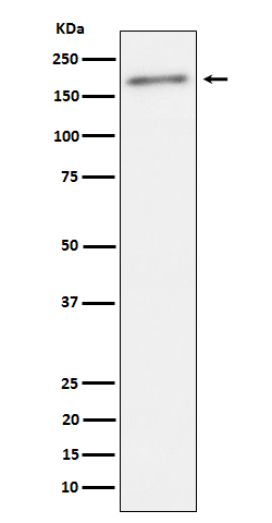 Phospho-ErbB2 (HER-2) (Tyr1221, Tyr1222) Antibody in Western Blot (WB)