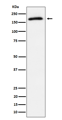 Phospho-AS160 (Thr642) Antibody in Western Blot (WB)