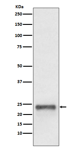 UBD Antibody in Western Blot (WB)