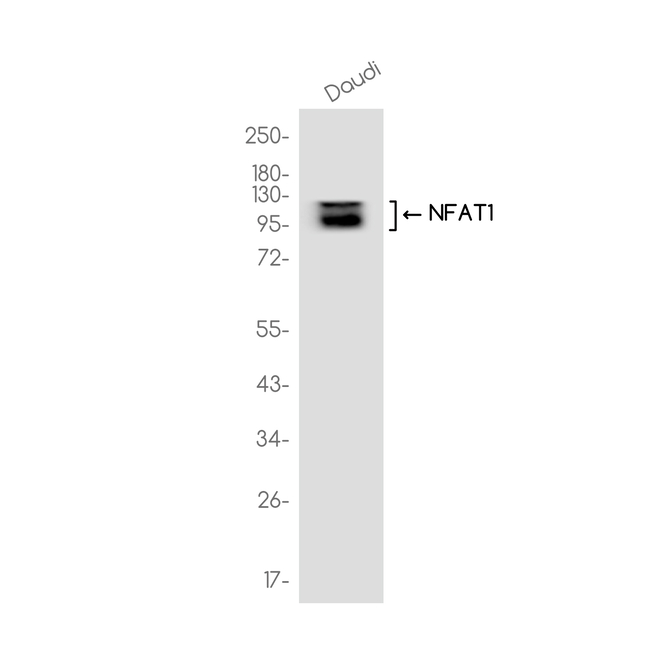 NFATC2 Antibody in Western Blot (WB)