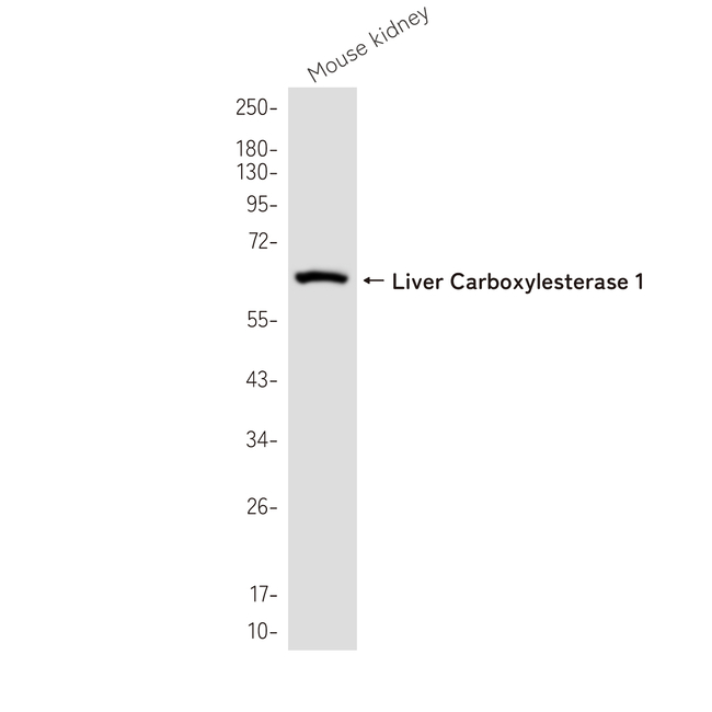 CES1 Antibody in Western Blot (WB)