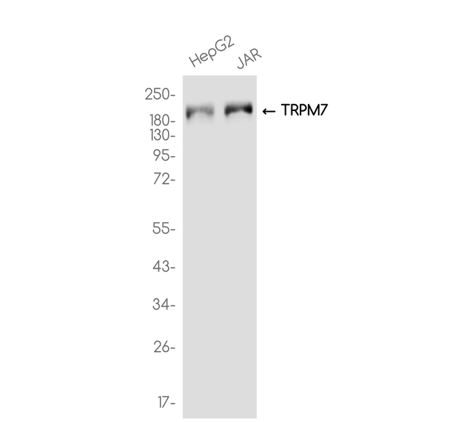 TRPM7 Antibody in Western Blot (WB)