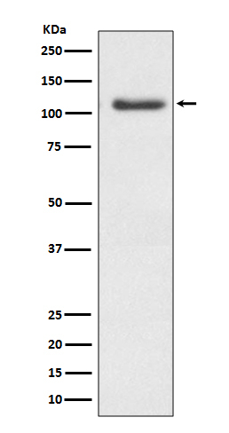 ERK5 Antibody in Western Blot (WB)