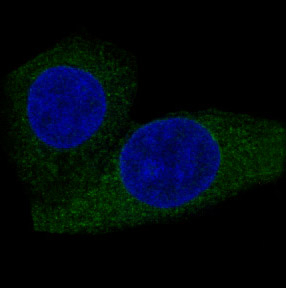 CPT2 Antibody in Immunocytochemistry (ICC/IF)