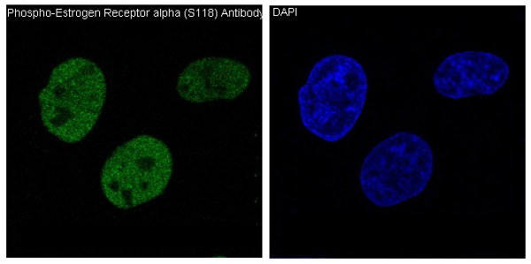Phospho-Estrogen Receptor alpha (Ser118) Antibody in Immunocytochemistry (ICC/IF)