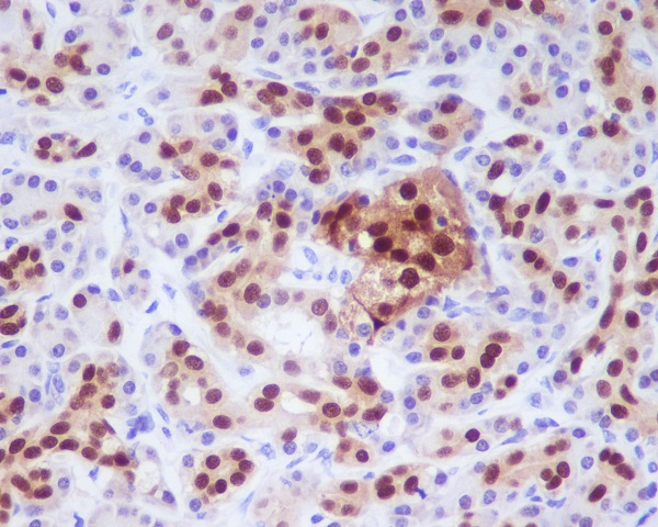 PDX1 Antibody in Immunohistochemistry (Paraffin) (IHC (P))