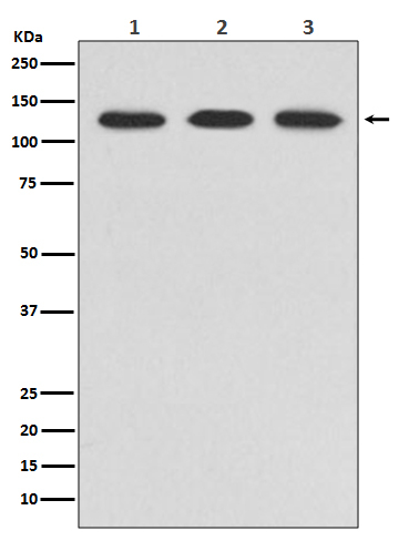 Abl2 Antibody in Western Blot (WB)