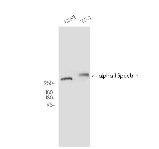 Spectrin alpha-1 Antibody in Western Blot (WB)