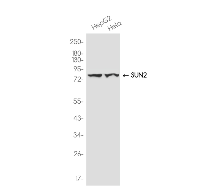UNC84B Antibody in Western Blot (WB)