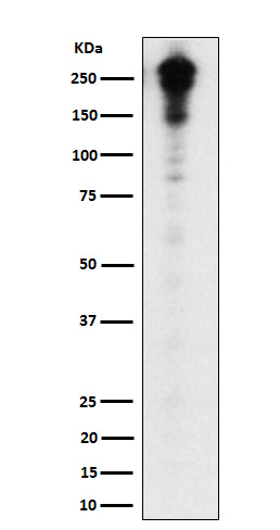Desmoplakin Antibody in Western Blot (WB)