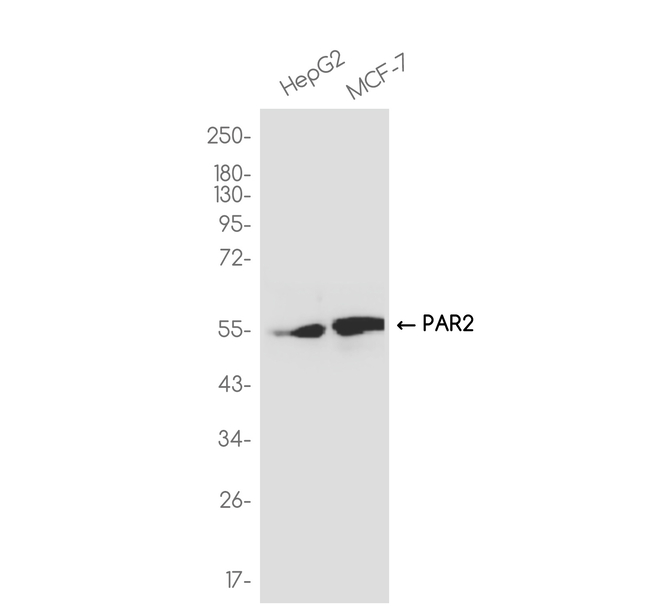 PAR2 Antibody in Western Blot (WB)