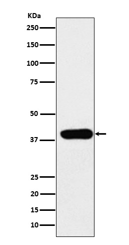 Adenosine Deaminase Antibody in Western Blot (WB)