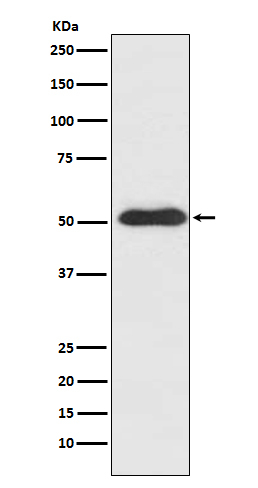 SLIT2 Antibody in Western Blot (WB)