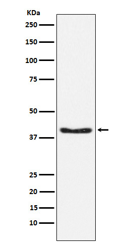 Phospho-PDHA1 (Ser293) Antibody in Western Blot (WB)