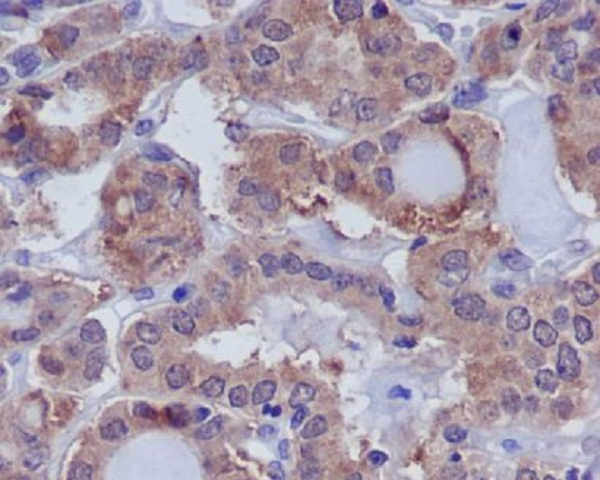 MKP3 Antibody in Immunohistochemistry (Paraffin) (IHC (P))