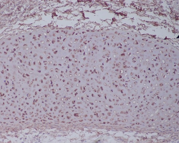 Aggrecan Antibody in Immunohistochemistry (Paraffin) (IHC (P))