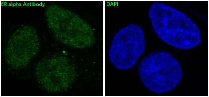 Estrogen Receptor alpha Antibody in Immunocytochemistry (ICC/IF)