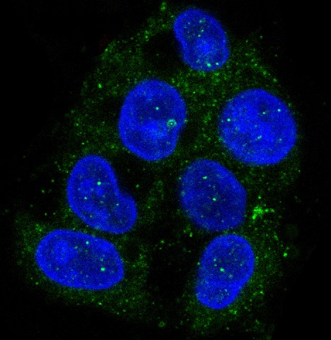 ATG9A Antibody in Immunocytochemistry (ICC/IF)
