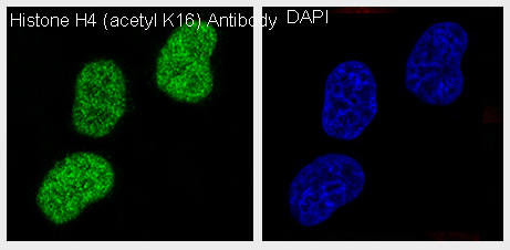 H4K16ac Antibody in Immunocytochemistry (ICC/IF)