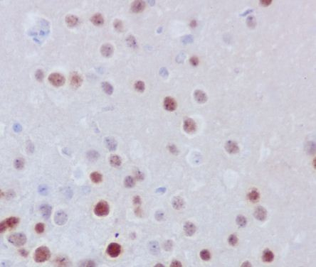 FosB Antibody in Immunohistochemistry (Paraffin) (IHC (P))