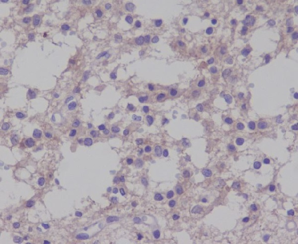 Phospho-TRKB (Tyr817) Antibody in Immunohistochemistry (Paraffin) (IHC (P))