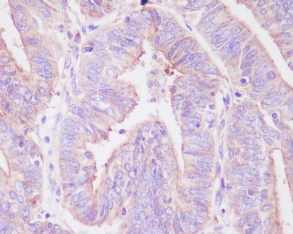 Phospho-FOXO3A (Ser253) Antibody in Immunohistochemistry (Paraffin) (IHC (P))