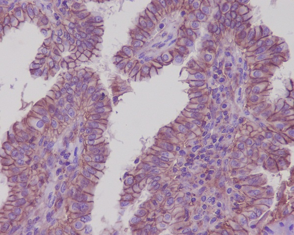 ATP1A1 Antibody in Immunohistochemistry (Paraffin) (IHC (P))