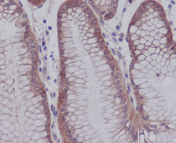 Phospho-YAP1 (Ser127) Antibody in Immunohistochemistry (Paraffin) (IHC (P))