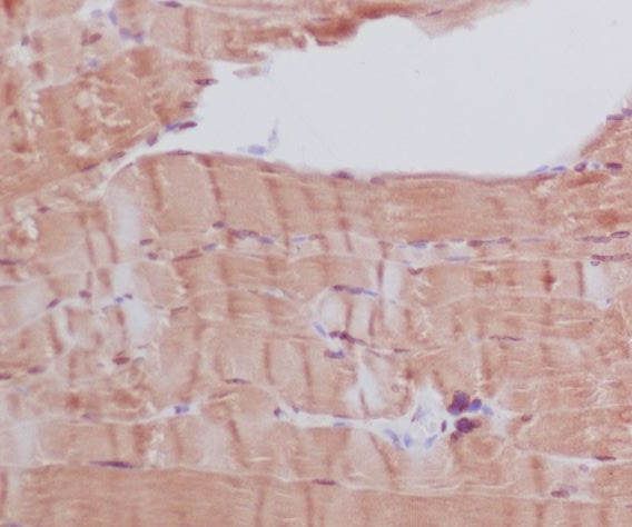 MYH6 Antibody in Immunohistochemistry (Paraffin) (IHC (P))