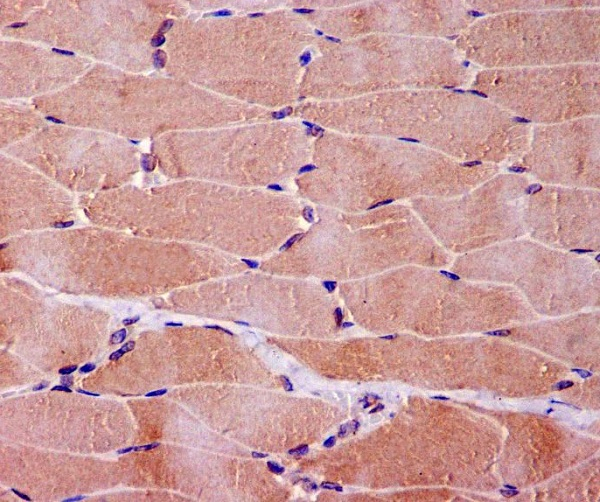 Myoglobin Antibody in Immunohistochemistry (Paraffin) (IHC (P))
