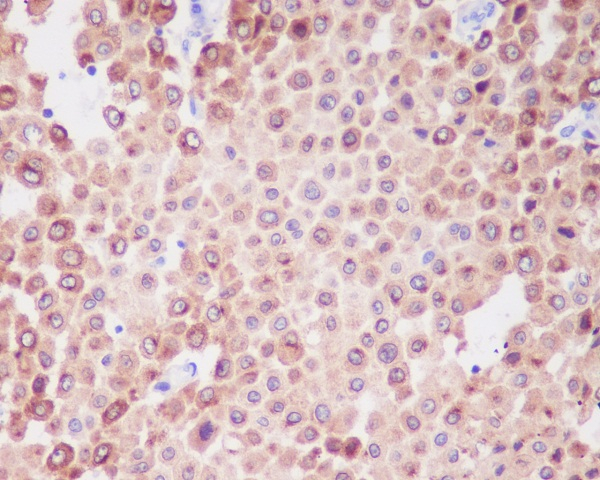 PMEL Antibody in Immunohistochemistry (Paraffin) (IHC (P))