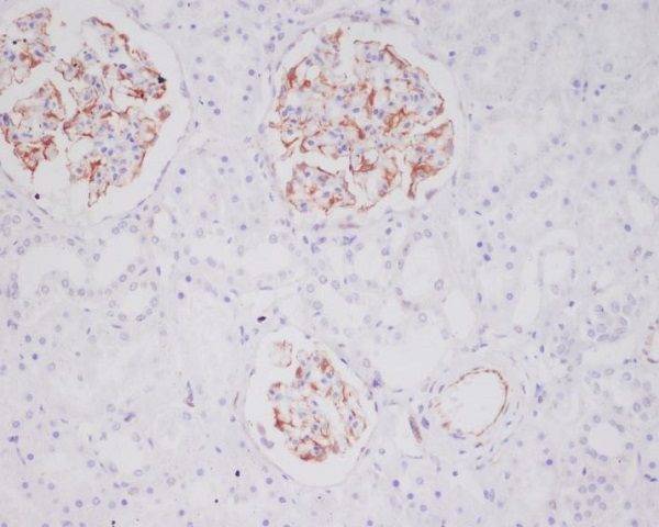 Tryptase Antibody in Immunohistochemistry (Paraffin) (IHC (P))