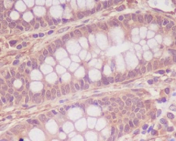MYLK Antibody in Immunohistochemistry (Paraffin) (IHC (P))