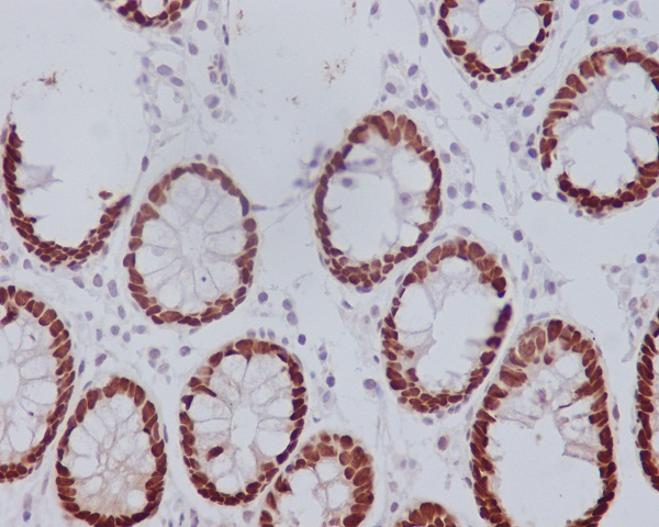 CDX2 Antibody in Immunohistochemistry (Paraffin) (IHC (P))