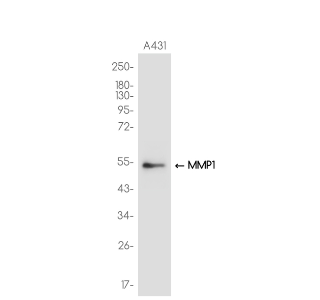 MMP1 Antibody in Western Blot (WB)