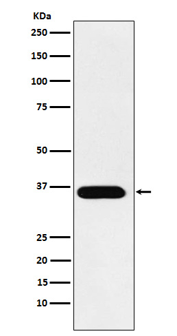 Tartrate Resistant Acid Phosphatase Antibody in Western Blot (WB)