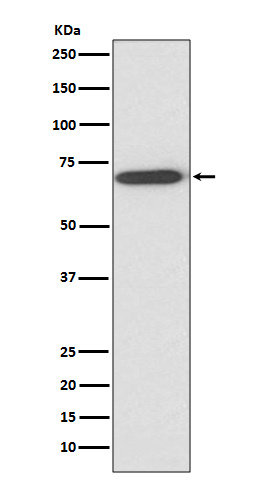 Perilipin 1 Antibody in Western Blot (WB)
