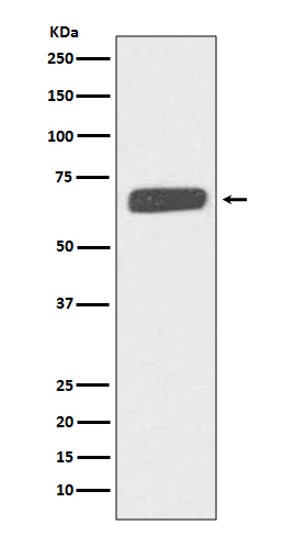 Collagen X Antibody in Western Blot (WB)