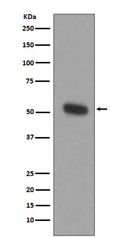 TPH1 Antibody in Western Blot (WB)
