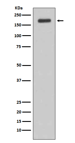 ErbB3 Antibody in Western Blot (WB)