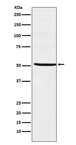 NR5A1 Antibody in Western Blot (WB)