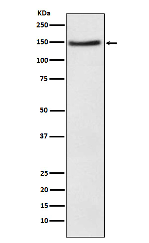 NPC1L1 Antibody in Western Blot (WB)