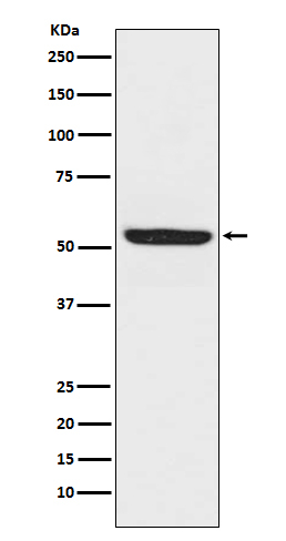 SPHK1 Antibody in Western Blot (WB)