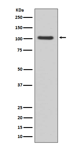 GluR1 Antibody in Western Blot (WB)