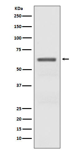 Phospho-AMPK alpha-2 (Thr172) Antibody in Western Blot (WB)