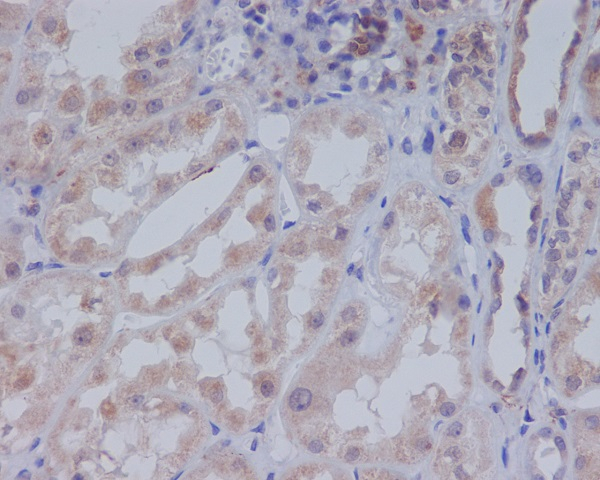 ACACA/ACACB Antibody in Immunohistochemistry (Paraffin) (IHC (P))